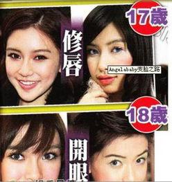 郑州整形失败爆料事件视频,揭秘美容行业潜规则与风险  第2张